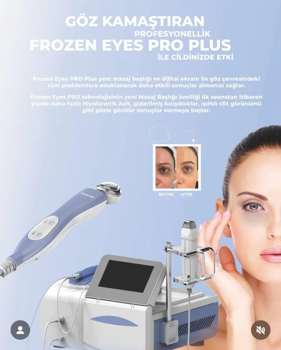 Frozen Eyes (İğnesiz Mezoterapi)